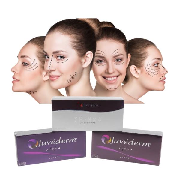 Face Lip Crosslinked Dermal Filler Juvederm Ultra3 Hyaluronic Acid Gel