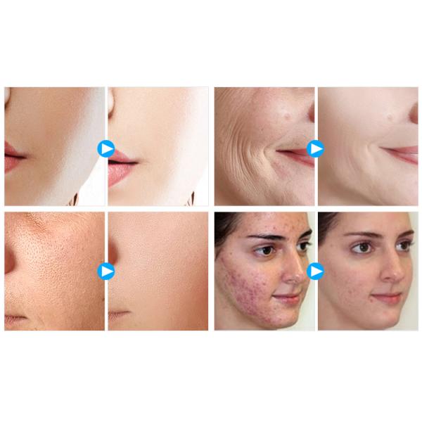 Promotion 15in1 Skin Care Blackhead Removal Face Lift Hydra Beauty Facial Machine