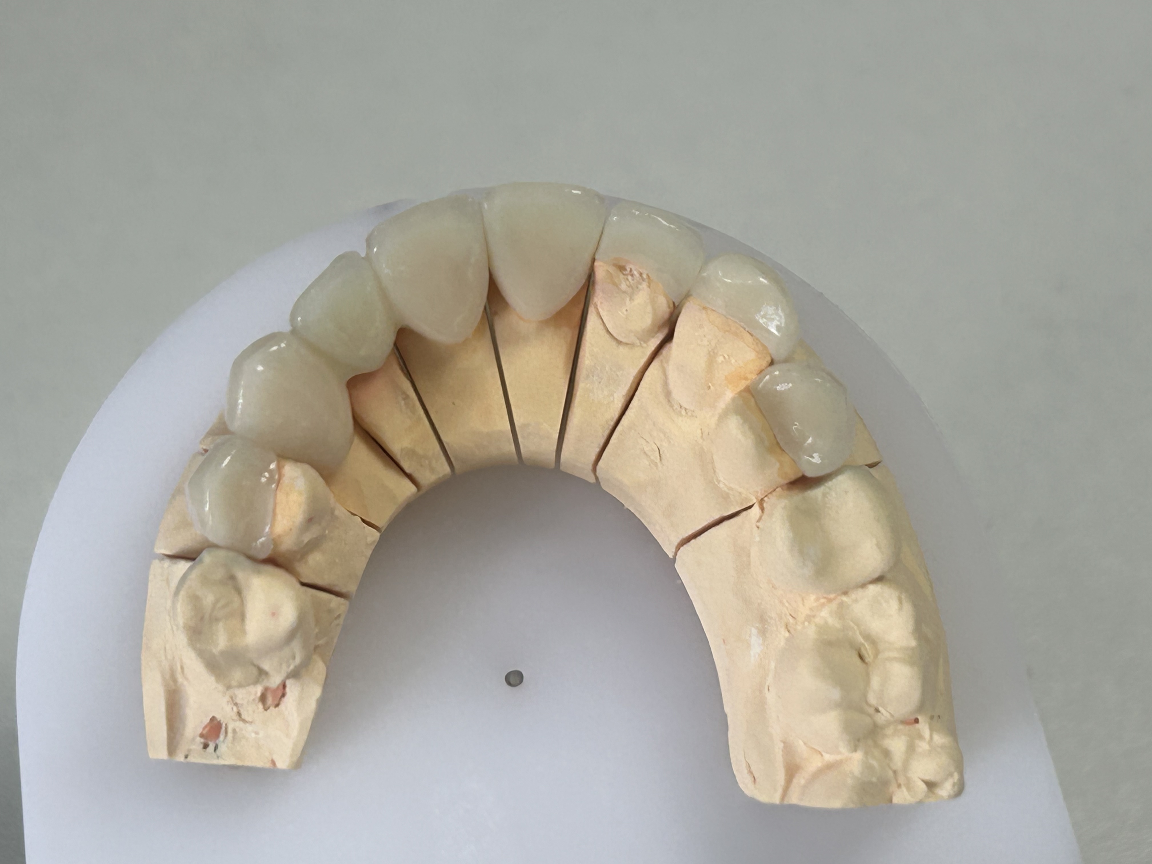 High Strength Full Zirconia Teeth with Natural Aesthetic from ShenZhen Dental Lab