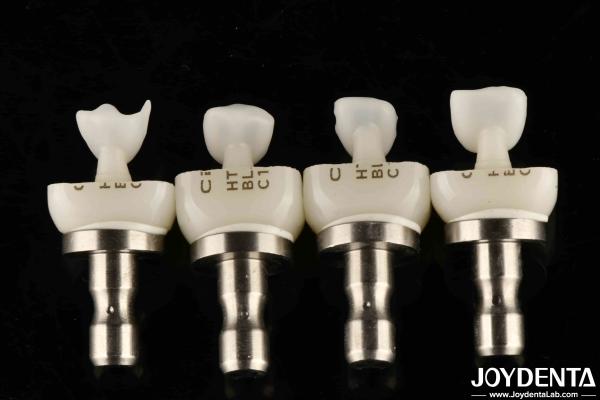 Customizable Glass Ceramic Veneer Dental Porcelain Veneers Long Lasting