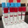 Siny Disposable Medical Beauty Clinic Vacuum Blood Collection Tube Prp Tubes Prf Kit Tube ISO