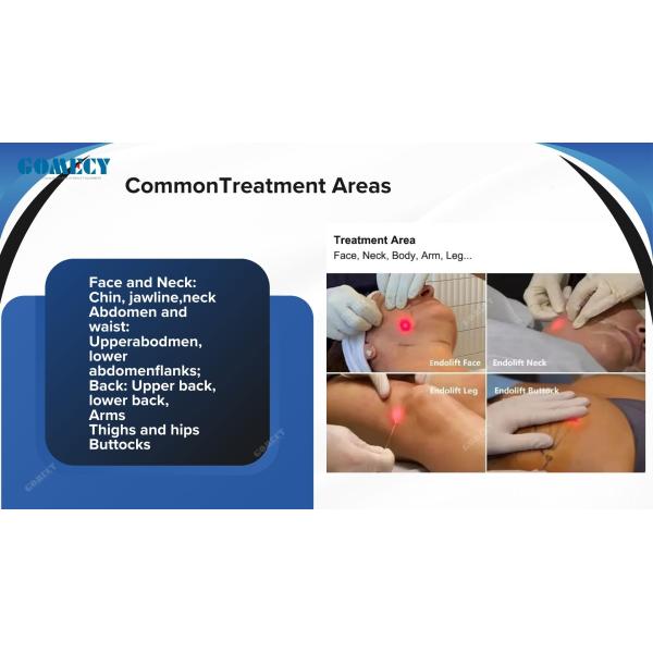 Endo Face Lifting Lipolysis Laser Liposuction Body Slimming Machine Diode 635 980 1470nm Endolaser Laser Equipment