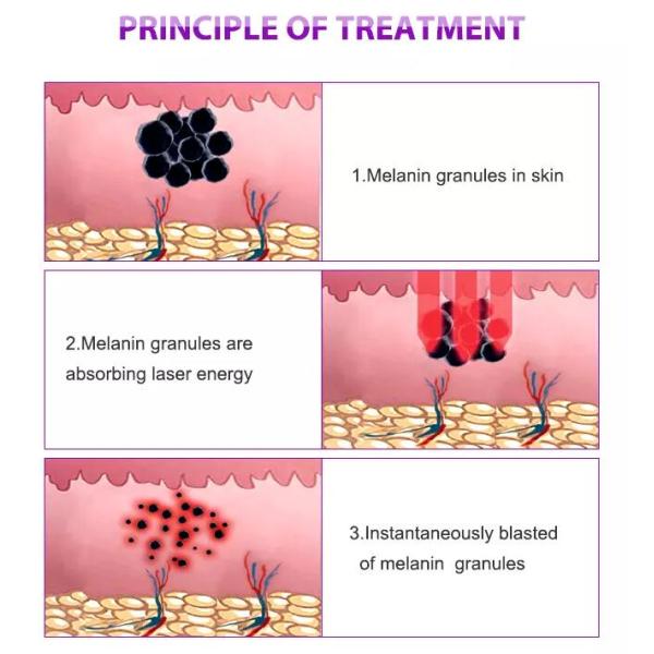 Professional Picosure Laser Machine , Q Switched Nd Yag Laser Tattoo Removal Equipment
