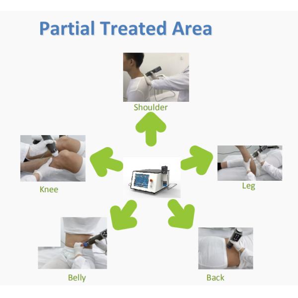 Оборудование для терапии ударными волнами ABS Пулсирующее электромагнитное поле