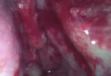 Система цифровой фотокамеры Endoscope видео- Otoscope камеры Otoscope USB медицинская с внутренним хранением 32G