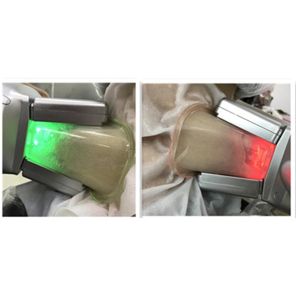 Жирное замерзая Cryolipolysis Cryo подвергает которые механической обработке двойные ручки 360 градусов