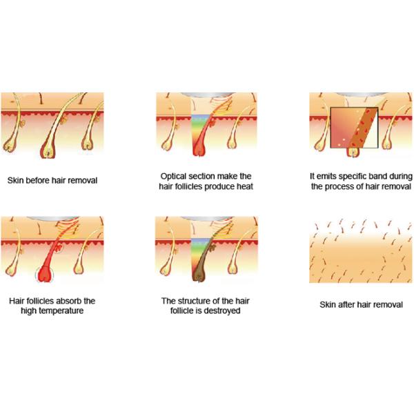 Máquina profesional del retiro del pelo del salón de belleza IPL SHR para el cuidado de piel sin dolor