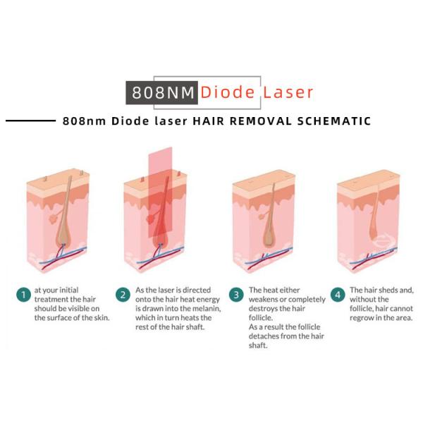 Máquina de depilación láser de diodo de 808 nm 2000W para salones