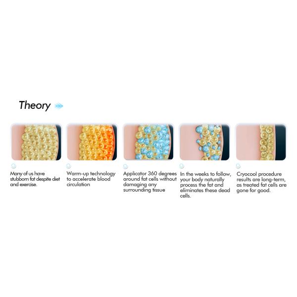 Fat Removal 360 cryo 5 handles Cryolipolysis machine 360 Cryolipolysis Slimming 4 cryo handles 4 cryo head