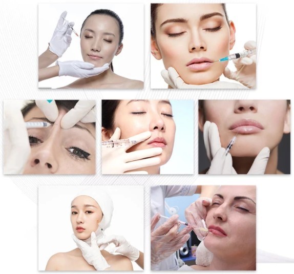 Морщинка дермального заполнителя Revolax Hyaluronic кисловочная глубокая извлекает