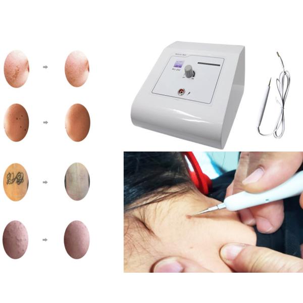 Face Pore Cleaner Skin Tag Removal Machine 110V 220V 12W CE Certified