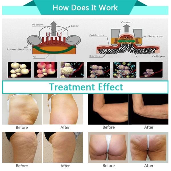 CE approval anti-aging body slimming beauty equipment rf vacuum roller massage machine