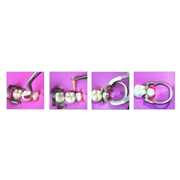 ISO Dental Sectional Matrix System Plastic Matrix Band Diamond Wedges W4 2.0