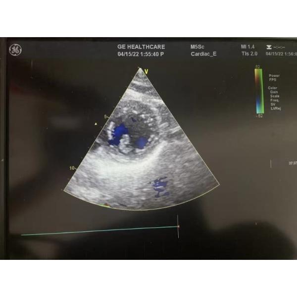 GE VividE95 оригинальный фазовый сердечный ультразвуковой зондирующий преобразователь M5SC-D