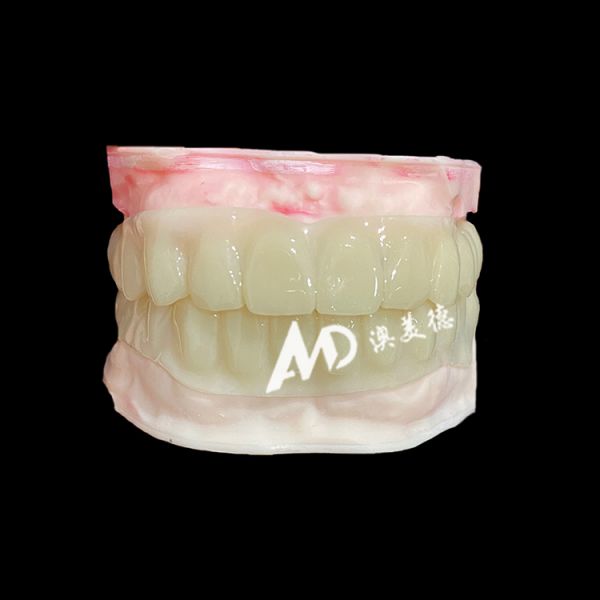 PMMA Hollow Temporary Bridges for Implant Provisional Cases