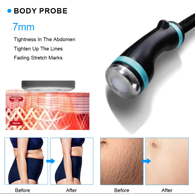 3 in1 Coldwave Shaping Device Face Lifting Body Contouring Skin Analysis Device
