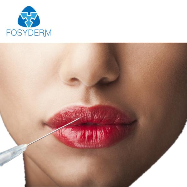 Sexy Lip Augmentation Hyaluronic Acid Dermal Filler No Side Effect Lip Filler