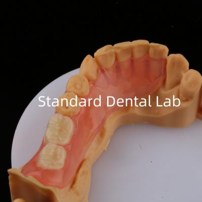 Modèle d'impression 3D Dentistique haute esthétique TCS Valplast Flexible Prothèses partielles Laboratoire dentaire