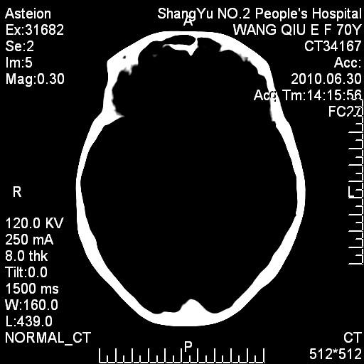 Konida Digital X-ray Medical Dry Thermal Printer Film KND-A, KND-F