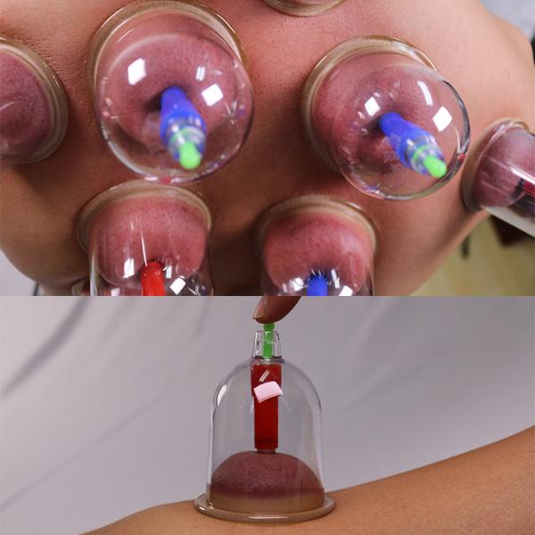 Transparent 18PCS Bio Magnetic Acuzon Plastic Vacuum Cupping Set with Aluminum Package