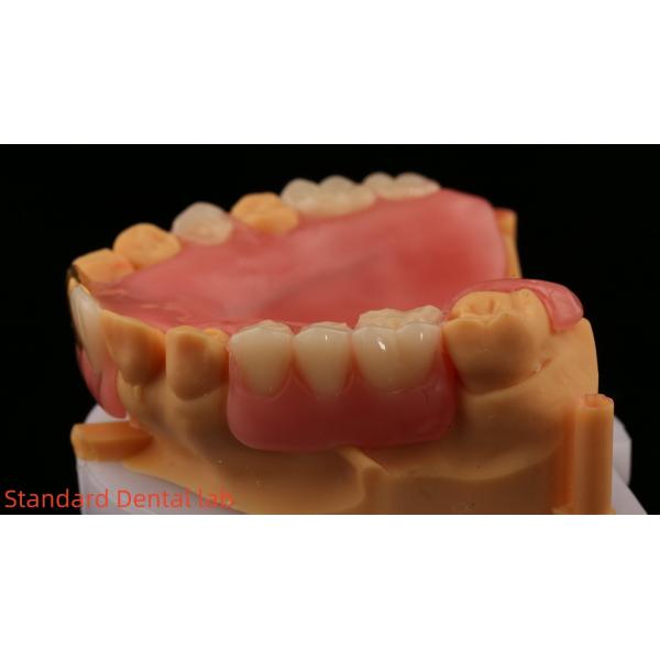 Full Acrylic Dentures With Yellow Gold Teeth/Dental Temporary Acrylic Denture Ivoclar Professional FDA Approved