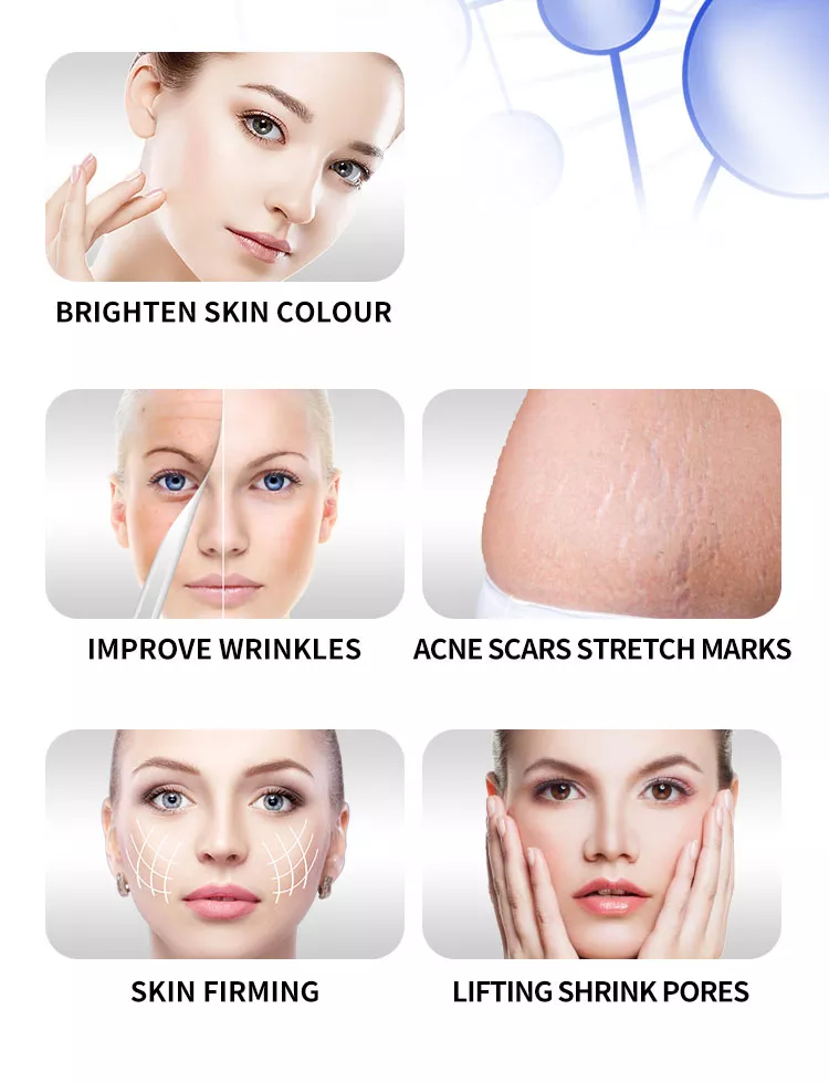 Professional RF Microneedling Machine for Face & Body Skin Rejuvenation and Weight Loss Portable Commercial Use