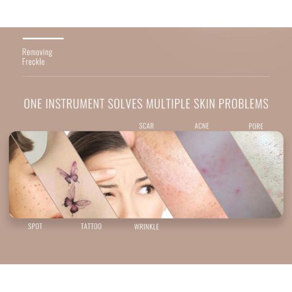 Машина 755nm 3000W удаления татуировки лазера пикосекунды переключателя q