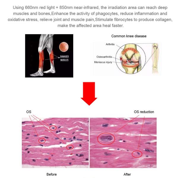 Photon Red Light Therapy Bed Skin Rejuvenation Collagen Body Slimming