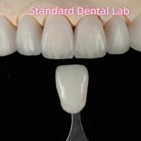 Pont dentaire en zirconium à haute esthétique naturel sur mesure