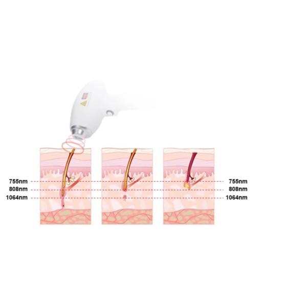 Оборудование красоты лазера диода 755 808 1064 подмолаживаний кожи удаления волос
