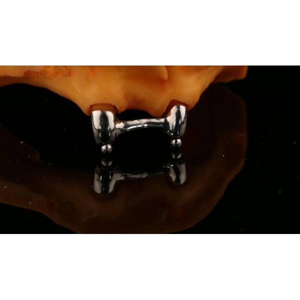 Ivoclar Digital Dental Implant Bar Denture with Attachments , Full Acrylic Titanium Implant Supported Dentures