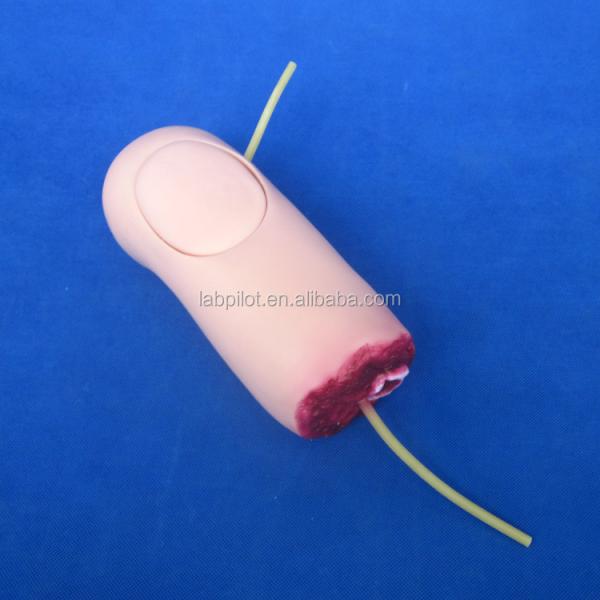 Advanced PVC Model The Ideal Solution for Lower Limb Trauma Thigh Amputation Nursing