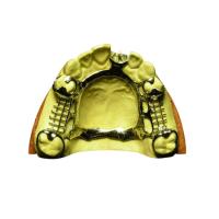 Suporte removível de Chrome do cobalto da dentadura da coroa dental removível durável