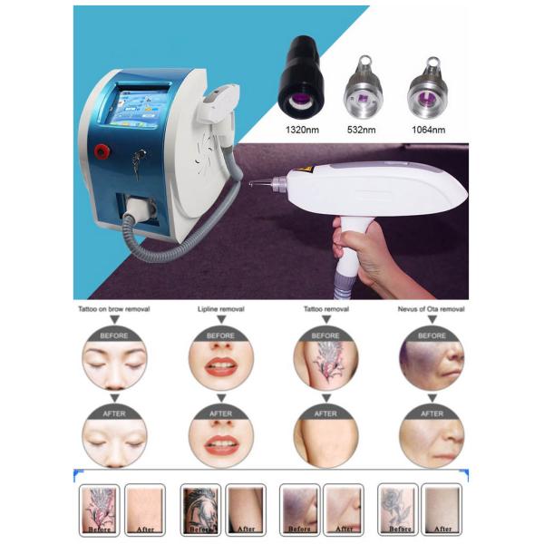 Популярная лазерная машина для удаления татуировок Nd Yag для отбеливания кожи