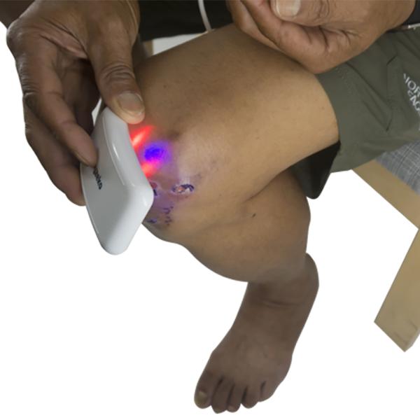 Hypertention / Cancer Laser Healing Device , Laser Therapy Watch With Red / Blue Light