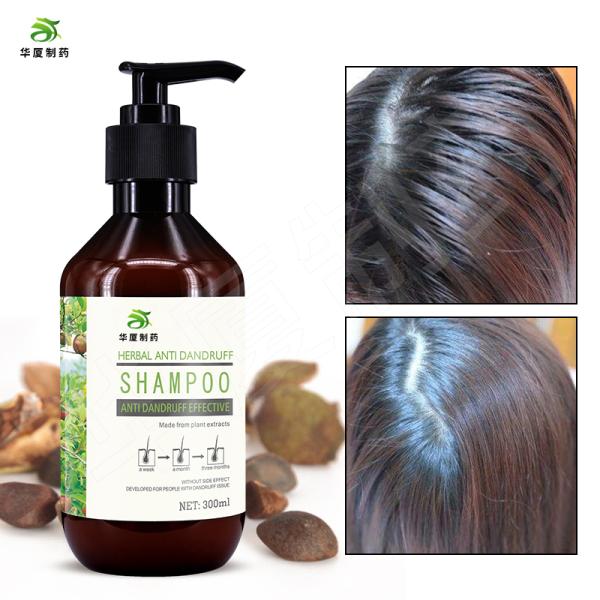 Oil Control Anti Dandruff Anti Itching Tea Tree Anti Hair Loss Shampoo 300ml