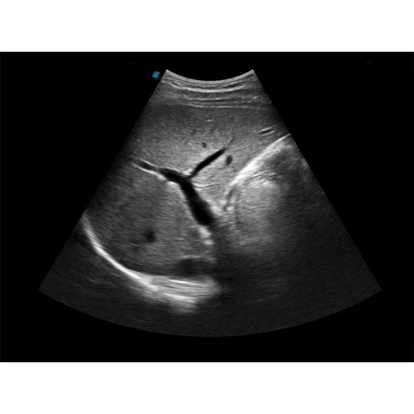15.6 Inch LED SonoScape Portable Color Doppler Ultrasound Machine BW Ultrasound