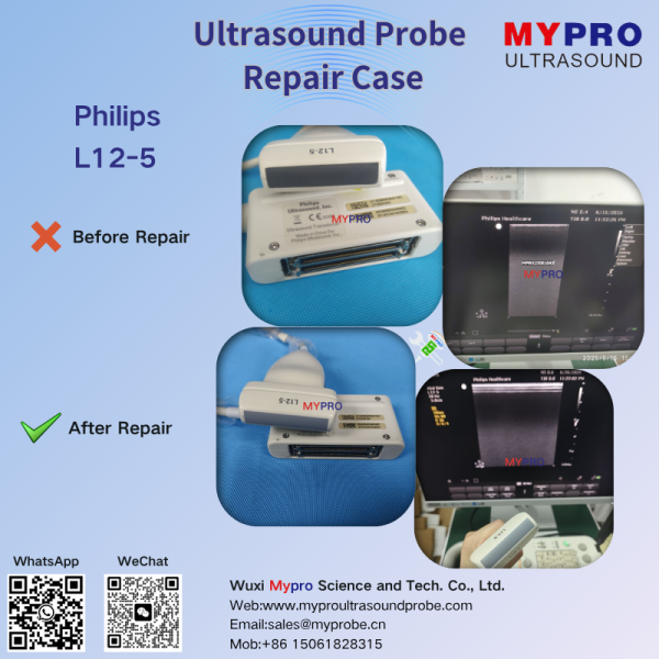 L12-5 Ultrasound Probe Repair Service for Acoustic Crystal Failure Repair in Medical Diagnosis