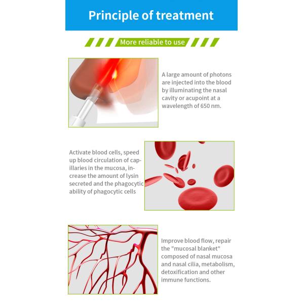 низший уровень ультракрасной машины терапией лазера 650нм носовой для КЭ/УПРАВЛЕНИЯ ПО САНИТАРНОМУ НАДЗОРУ ЗА КАЧЕСТВОМ ПИЩЕВЫХ ПРОДУКТОВ И МЕДИКАМЕНТОВ Рхинитис