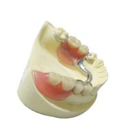 Produits dentaires de laboratoire de dentiers de restauration partielle démontable en acier de dentier