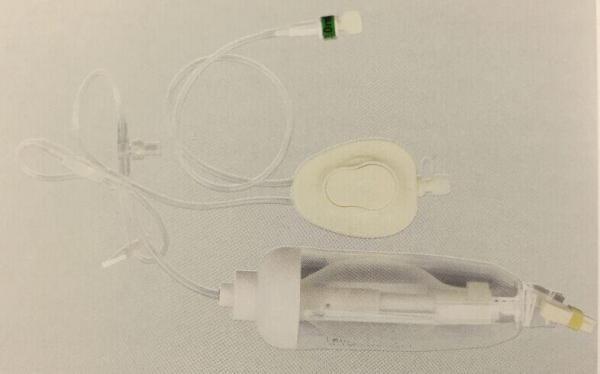 Conjunto de infusão de bomba de plástico de PVC de grau médico com conector de fecho Luer