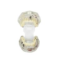 Modelo de dente patológico transparente com personalização do nervo do dente