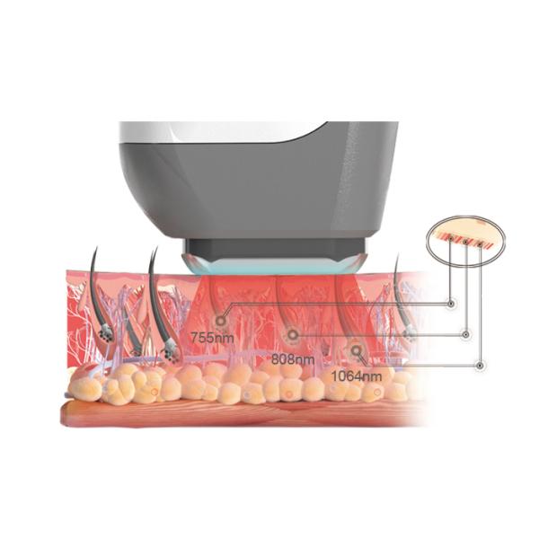 Painfree And Permanent Diode Laser Hair Removal Machine 10 - 1400ms Adjustable