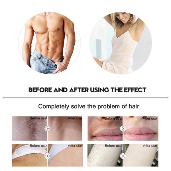 4 In1 Home Beauty Machine 500000 Pulsed IPL Laser Hair Removal Permanent Epilator Armpit
