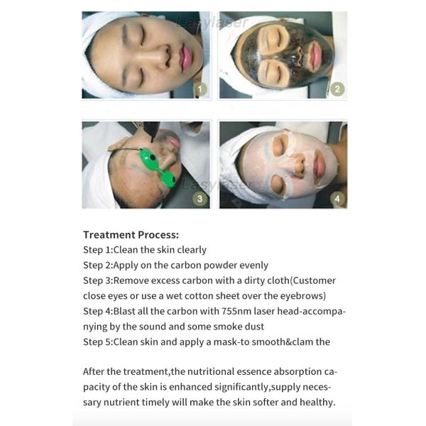 Q Switched Laser Tattoo Removal Machine 800W ND YAG Tattoo Removal Machine