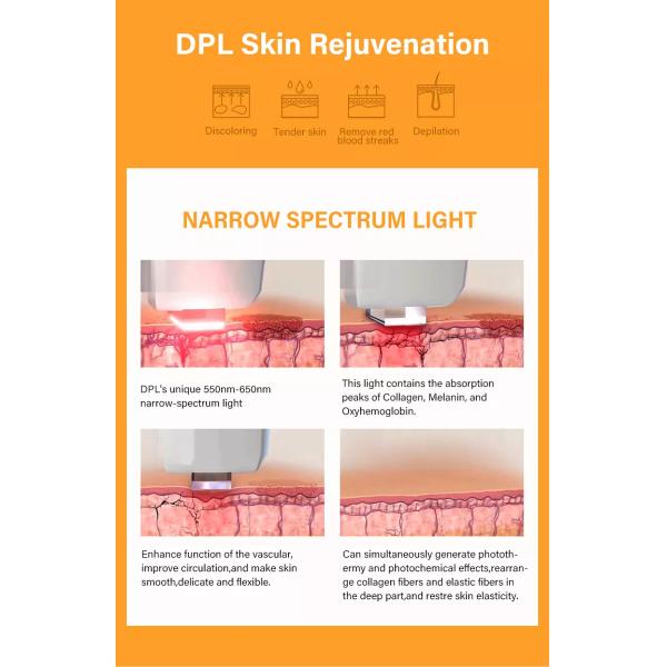 Углерод слезает лед объектива крутой выбирает машина удаления волос на лице Ipl для удаления родимого пятна сопл женщин 755nm