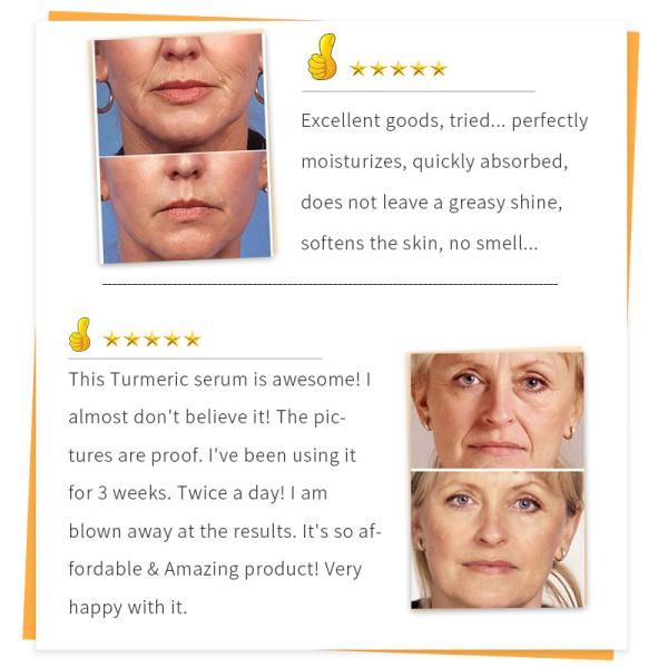 30ml Turmeric Essence Face Serum Dark Spot Corrector Serum Formaldehyde Free