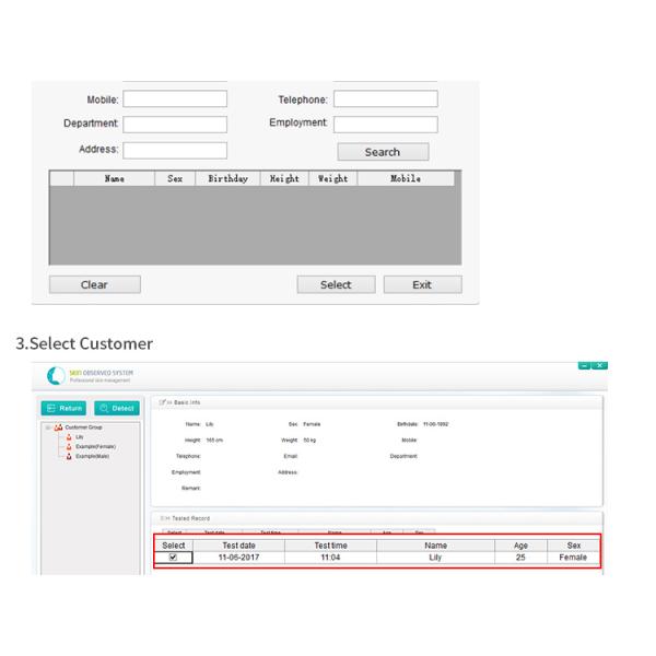 Блок развертки влаги камеры кожи умной машины анализа кожи Усб лицевой с программным обеспечением