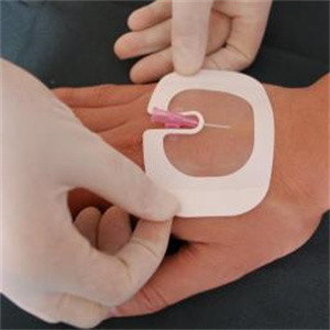 пусковые площадки 5*6cm водоустойчивые прозрачные одевая стерильные слипчивые для ран