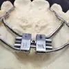 3D Printing Minimal Prep Orthodontic Arch Expander For Teenager